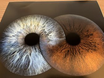 フランスのリヨンにある虹彩をアートにするIris Galerie で作ってもらった写真